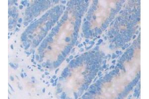 DAB staining on IHC-P; Samples: Rat Small intestine Tissue (HSD17B12 antibody  (AA 11-291))