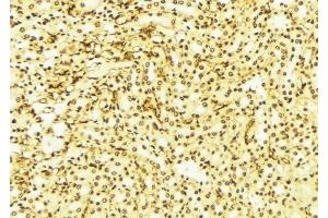 ABIN6276347 at 1/100 staining Mouse liver tissue by IHC-P. (SIRT2 antibody  (C-Term))