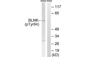 Western blot analysis of extracts from K562 cells, treated with starved (24hours), using BLNK (Phospho-Tyr84) antibody. (B-Cell Linker antibody  (pTyr84))