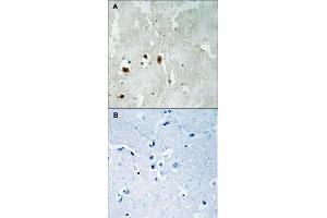 Immunohistochemical staining of human brain tissue by KAT5 (phospho S90) polyclonal antibody  without blocking peptide (A) or preincubated with blocking peptide (B) under 1:50-1:100 dilution. (KAT5 antibody  (pSer90))