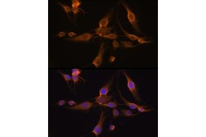 Immunofluorescence analysis of C6 cells using GST Rabbit pAb (8266) at dilution of 1:100 (40x lens). (GSTA1 antibody  (AA 1-222))