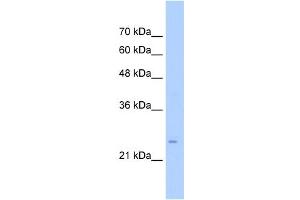 WB Suggested Anti-TMEM69 Antibody Titration:  0. (TMEM69 antibody  (Middle Region))