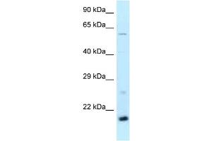 WB Suggested Anti-Dr1 Antibody Titration: 1. (DR1 antibody  (Middle Region))