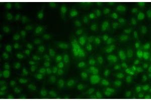 Immunofluorescence analysis of A549 cells using KLF3 Polyclonal Antibody (KLF3 antibody)