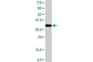 Western Blot detection against Immunogen (36. (DYRK1B antibody  (AA 479-569))
