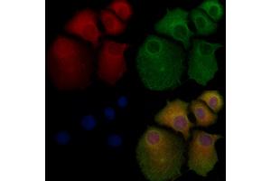 ABIN6261285 and ABIN6276758 staining Hela cells by IF/ICC. (Dihydrofolate Reductase antibody  (N-Term))