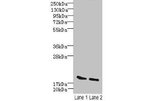 Western blot All lanes: SKP1 antibody at 15 μg/mL Lane 1: Mouse brain tissue Lane 2: Hela whole cell lysate Secondary Goat polyclonal to rabbit IgG at 1/10000 dilution Predicted band size: 19 kDa Observed band size: 19 kDa (SKP1 antibody  (AA 2-163))