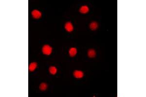 Immunofluorescent analysis of Separase (pS801) staining in MDAMB231 cells. (Separase antibody  (pSer801))