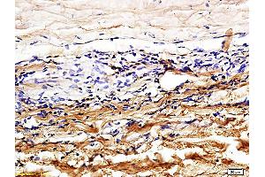 Formalin-fixed and paraffin embedded rabbit sclera tissue labeled with Rabbit Anti-CD31/PECAM-1 Polyclonal Antibody (ABIN726140) at 1:600 followed by conjugation to the secondary antibody and DAB staining. (CD31 antibody  (AA 681-738))