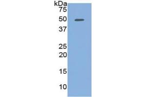 WB of Protein Standard: different control antibodies against Highly purified E. (PCOLCE ELISA Kit)