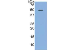 WB of Protein Standard: different control antibodies against Highly purified E. (PCOLCE ELISA Kit)