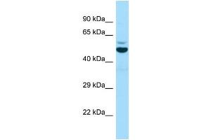 WB Suggested Anti-EDC3 Antibody Titration: 1. (EDC3 antibody  (Middle Region))