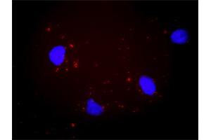 Proximity Ligation Analysis of protein-protein interactions between PTK2 and ITGAV. (CD51 antibody  (AA 1-1048))