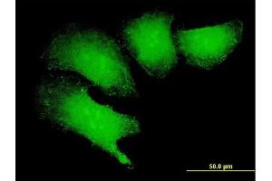 Immunofluorescence of purified MaxPab antibody to MAGEB18 on HeLa cell. (MAGEB18 antibody  (AA 1-343))