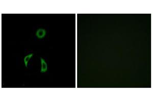 Immunofluorescence analysis of A549 cells, using FZD3 antibody.