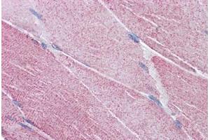 Human Skeletal Muscle: Formalin-Fixed, Paraffin-Embedded (FFPE) (PCSK6 antibody  (AA 637-648))
