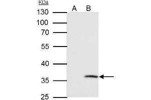 IP Image VDAC2 antibody [C2C3], C-term immunoprecipitates VDAC2 protein in IP experiments. (VDAC2 antibody  (C-Term))