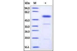 Human PLAU, His Tag on SDS-PAGE under reducing (R) condition. (PLAU Protein (AA 21-431) (His tag))