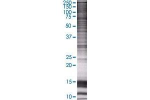 ERCC5 transfected lysate. (ERCC5 293T Cell Transient Overexpression Lysate(Denatured))