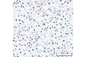 IHC analysis of Nesprin3/SYNE3 using anti-Nesprin3/SYNE3 antibody (ABIN7601328). (Nesprin3 antibody  (AA 322-495))