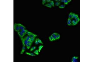Immunofluorescent analysis of PC-3 cells using ABIN7157524 at dilution of 1:100 and Alexa Fluor 488-congugated AffiniPure Goat Anti-Rabbit IgG(H+L) (KIR3DL1 antibody  (AA 81-336))