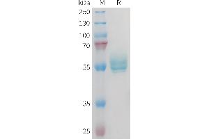 Tumor Necrosis Factor (Ligand) Superfamily, Member 15 (TNFSF15) protein (Fc Tag)