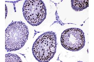 IHC analysis of MED8 using anti-MED8 antibody . (MED8 antibody  (AA 1-195))