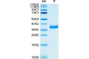 SDS-PAGE (SDS) image for SARS-CoV-2 Spike (E484K), (K417N), (N501Y), (RBD) protein (His tag) (ABIN7274387)
