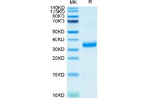 SARS-COV-2 Spike RBD (N501Y,K417N,E484K) on Tris-Bis PAGE under reduced condition. (SARS-CoV-2 Spike Protein (E484K, K417N, N501Y, RBD) (His tag))