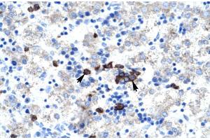 Human kidney (Activator of Basal Transcription 1 antibody  (Middle Region))