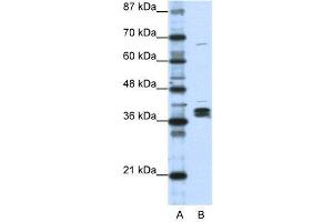 Western Blotting (WB) image for anti-Heterogeneous Nuclear Ribonucleoprotein D-Like (HNRPDL) (Middle Region) antibody (ABIN2778937)