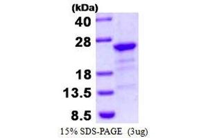 Image no. 1 for Hepatitis B Virus X-Interacting Protein (HBXIP) protein (His tag) (ABIN1098350) (HBXIP Protein (His tag))