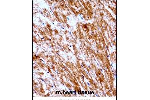 Mouse Pdk2 Antibody (N-term) ((ABIN657996 and ABIN2846942))immunohistochemistry analysis in formalin fixed and paraffin embedded mouse heart tissue followed by peroxidase conjugation of the secondary antibody and DAB staining. (PDK2 antibody  (N-Term))