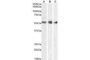 ABIN185674 (1µg/ml) staining of Human Spleen (A), Kidney (B) and Testis (C) lysates (35µg protein in RIPA buffer). (WT1 antibody  (N-Term))
