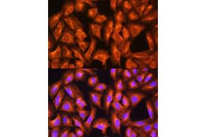 Immunofluorescence analysis of U2OS cells using GNAS Rabbit pAb (ABIN6127959, ABIN6141213, ABIN6141214 and ABIN6221191) at dilution of 1:100.