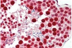 Human Testis: Formalin-Fixed, Paraffin-Embedded (FFPE) (TARDBP antibody  (AA 1-30))