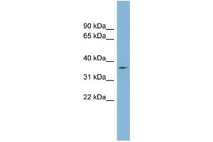 WB Suggested Anti-TMPRSS12 Antibody Titration: 0. (TMPRSS12 antibody  (Middle Region))
