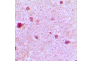 Immunohistochemical analysis of ZFP36L1 staining in human brain formalin fixed paraffin embedded tissue section. (ZFP36L1 antibody  (Center))