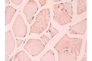 Detection of CA12 in Rat Skeletal muscle Tissue using Polyclonal Antibody to Carbonic Anhydrase XII (CA12) (CA12 antibody  (AA 154-307))