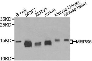 Western blot analysis of extracts of various cell lines, using MRPS6 antibody (ABIN6003616) at 1/1000 dilution. (MRPS6 antibody)