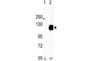 Western blot analysis of EphA2 antibody and 293 cell lysate (2 ug/lane) either nontransfected (Lane 1) or transiently transfected with the EphA2 gene (2). (EPH Receptor A2 antibody  (AA 919-950))