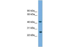 WB Suggested Anti-RAB35 Antibody Titration: 0. (RAB35 antibody  (Middle Region))