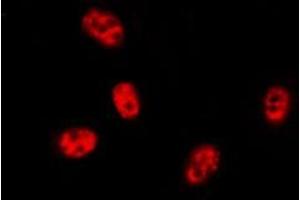 ABIN6276437 staining HEPG2 cells by ICC/IF. (BIRC2 antibody  (C-Term))