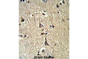 Immunohistochemistry (IHC) image for anti-Glycerol-3-Phosphate Dehydrogenase 1 (Soluble) (GPD1) antibody (ABIN3003779) (GPD1 antibody)
