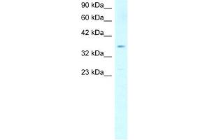 WB Suggested Anti-SCD Antibody Titration:  1.