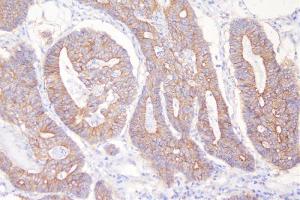 IHC analysis of DSG2 using anti-DSG2 antibody (ABIN7600803). (Desmoglein 2 antibody  (AA 24-1020))