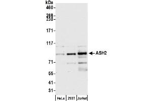 Western Blotting (WB) image for anti-Achaete-Scute Complex Homolog 2 (ASCL2) (AA 225-275) antibody (ABIN7454590) (ASCL2 antibody  (AA 225-275))