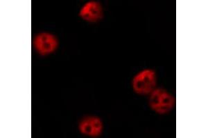 ABIN6274198 staining HeLa by IF/ICC. (CSRP1 antibody  (Internal Region))