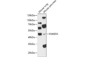 Western blot analysis of extracts of various cell lines, using FA antibody (ABIN7267120) at 1:1000 dilution. (FAM83A antibody  (AA 1-160))