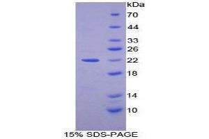 SDS-PAGE (SDS) image for Early Growth Response 1 (EGR1) (AA 273-431) protein (His tag) (ABIN2124684)